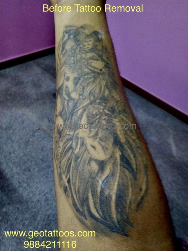 gallery/Geo_Tattoos_Removal-2.jpg